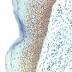 FFPE human skin sections stained with 100 ul anti-E-Cadherin / CD324 (clone SPM381) at 1:50. HIER epitope retrieval prior to staining was performed in 10mM Citrate, pH 6.0.